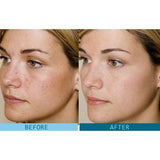 35% Glycolic Acid Peel Kit For Facial Skin Care - Chemical Peel