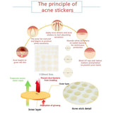 Beauty Acne Patch Set (24 PCS) - Acne Patches