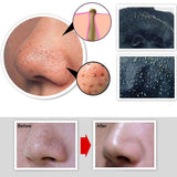 BlackHead Peel Off Mask - Facial Purifying - Blackhead Remover