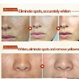 Facial Skin Whitening Cream For Dark Spots - Skin Care