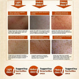 Facial Skin Whitening Cream For Dark Spots - Skin Care