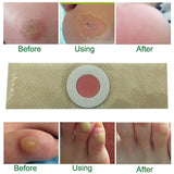 Foot Corn Remover - Foot Corn Remover