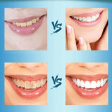 Natural Activated Charcoal Teeth Whitening Powder - Teeth Whitening Powder