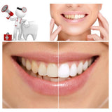 Natural Activated Charcoal Teeth Whitening Powder - Teeth Whitening Powder