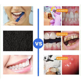 Natural Activated Charcoal Teeth Whitening Powder - Teeth Whitening Powder