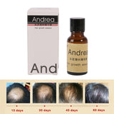Natural Hair Growth Essence - Health & Beauty > Personal Care > Hair Care > Hair Loss Treatments