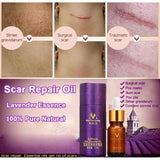 Scar Repair Natural Skin Oil - skin care