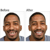 Smile Ready Cosmetic Fake Teeth - Fake Teeth