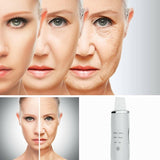 Ultrasonic Facial Cleaner - Pore cleaner