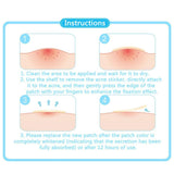 Beauty Acne Patch Set (24 PCS) - Acne Patches