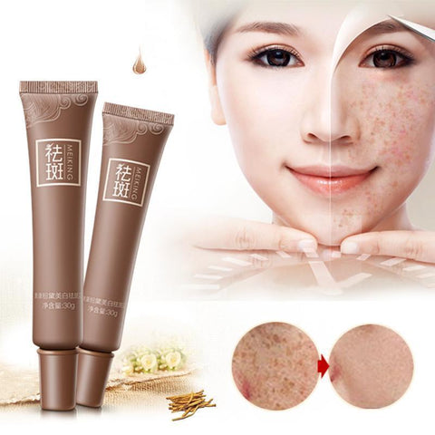 Facial Skin Whitening Cream For Dark Spots - Skin Care