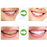 Natural Activated Charcoal Teeth Whitening Powder - Teeth Whitening Powder