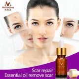 Scar Repair Natural Skin Oil - skin care