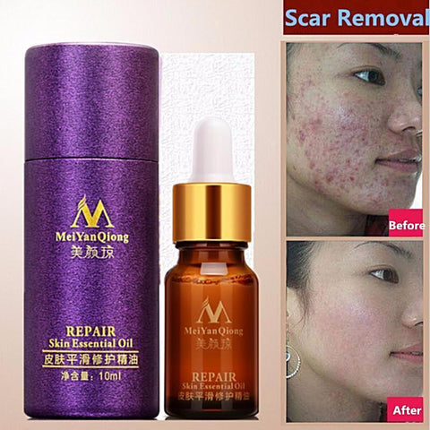 Scar Repair Natural Skin Oil - skin care
