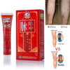 Varicose Veins Treatment Cream - Cream